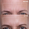 Forehead Wrinkle Patches